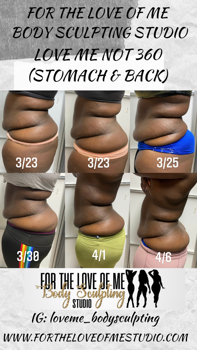 For the Love of Me Body Sculpting Studio Miami Gardens - Wellness Retreat in Miami Gardens