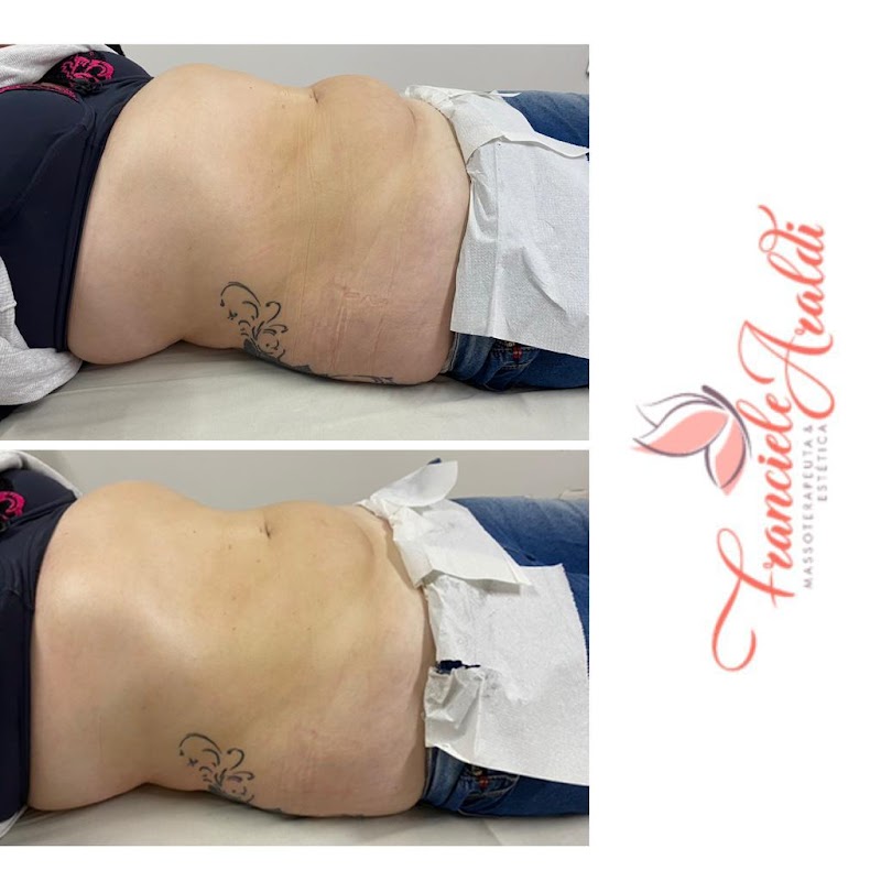 Franciele Araldi Massoterapeuta e Estetica Farroupilha - Day Spa in Farroupilha