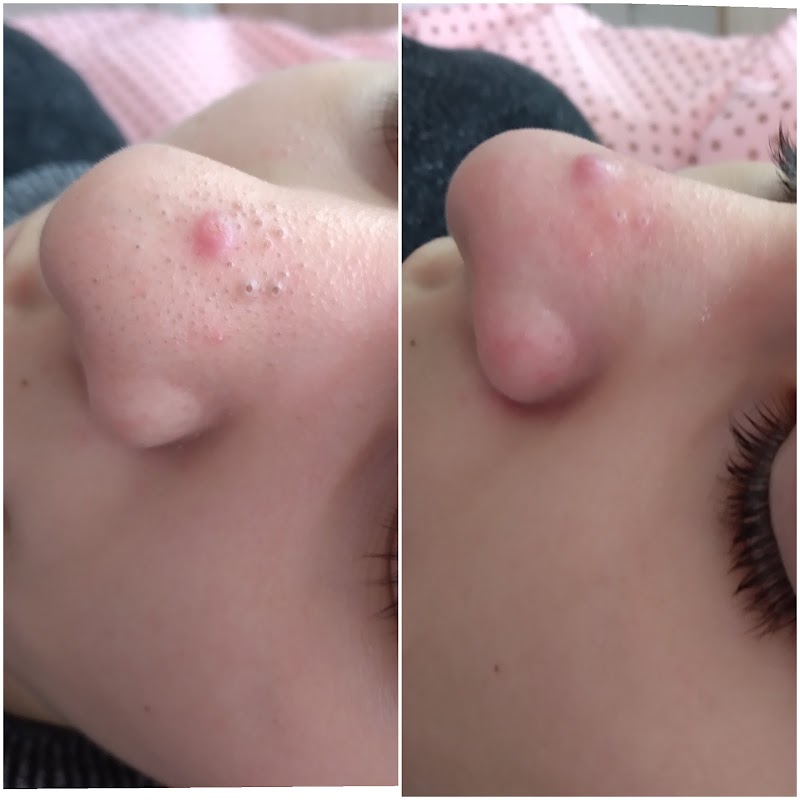 Gabriela Santos Estética Facial Guaíba - Day Spa in Guaíba