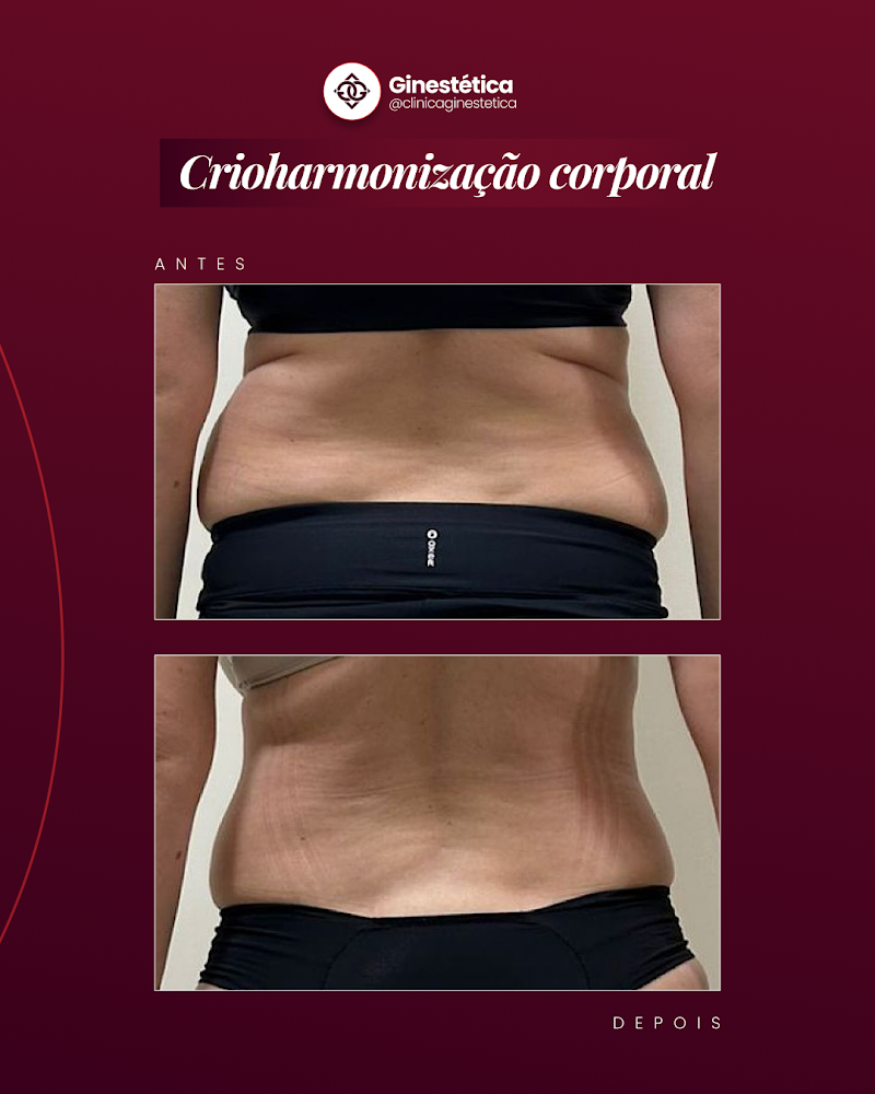 Ginestética Indaial - Day Spa in Indaial