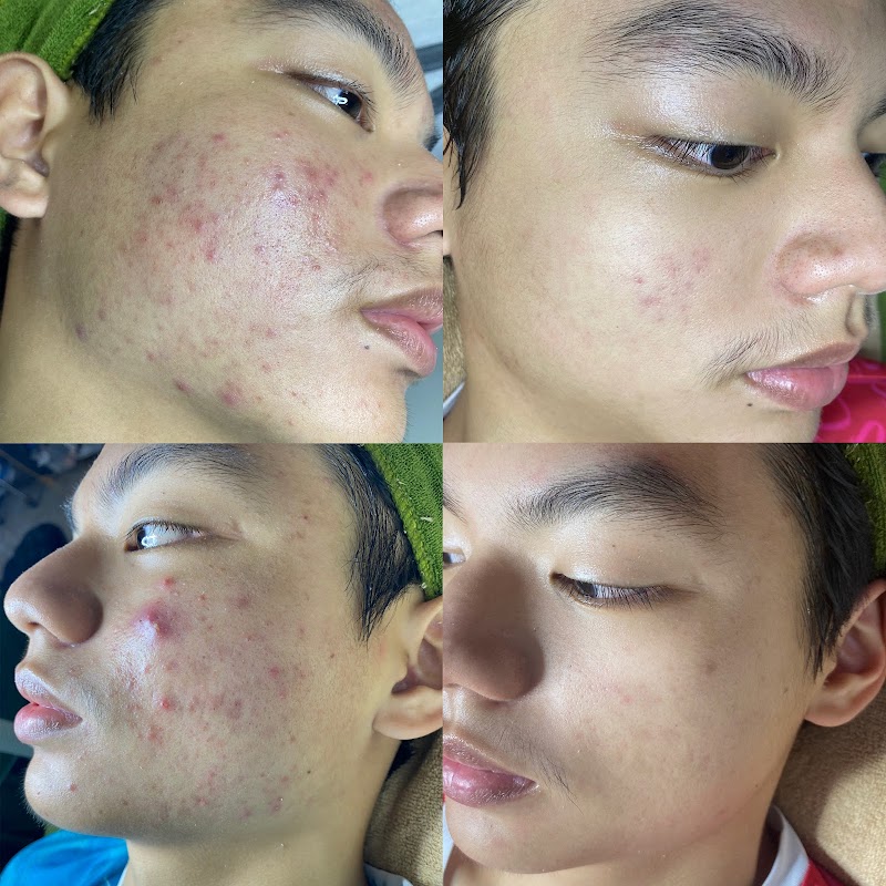 Hậu Spa Chăm Sóc Da Pleiku - Day Spa in Pleiku