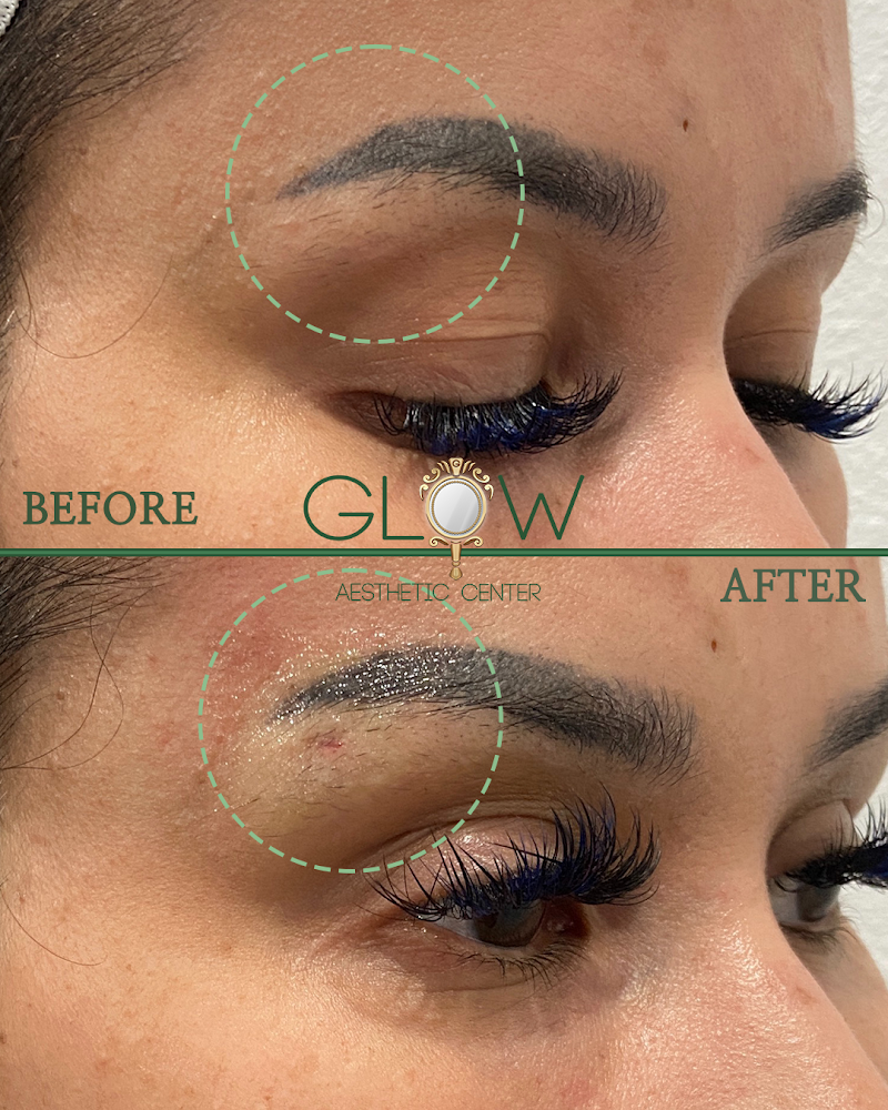 HiSpa Medical Spa & Salon Los Angeles - Medical Spa in Los Angeles