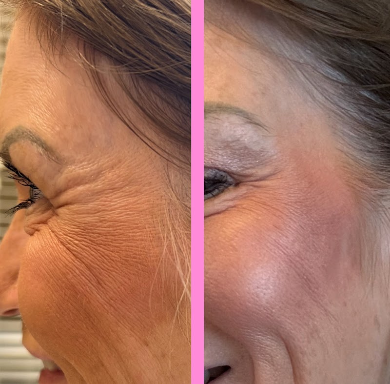 Innova Skin & Wellness Spa Flower Mound - Wellness Retreat in Flower Mound