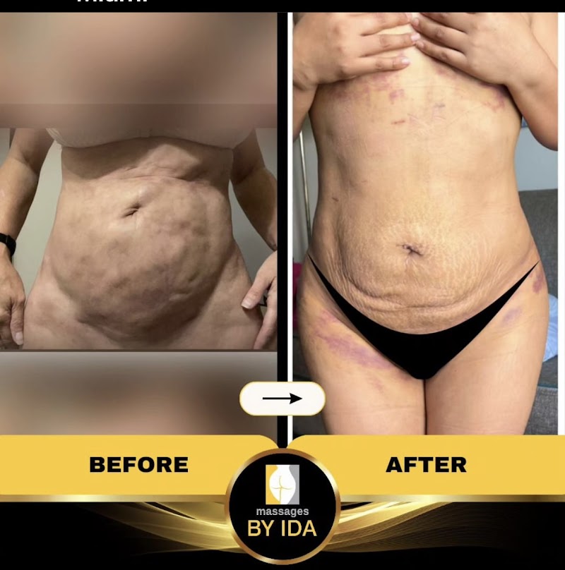 Interventional Massage Therapy Miami photo