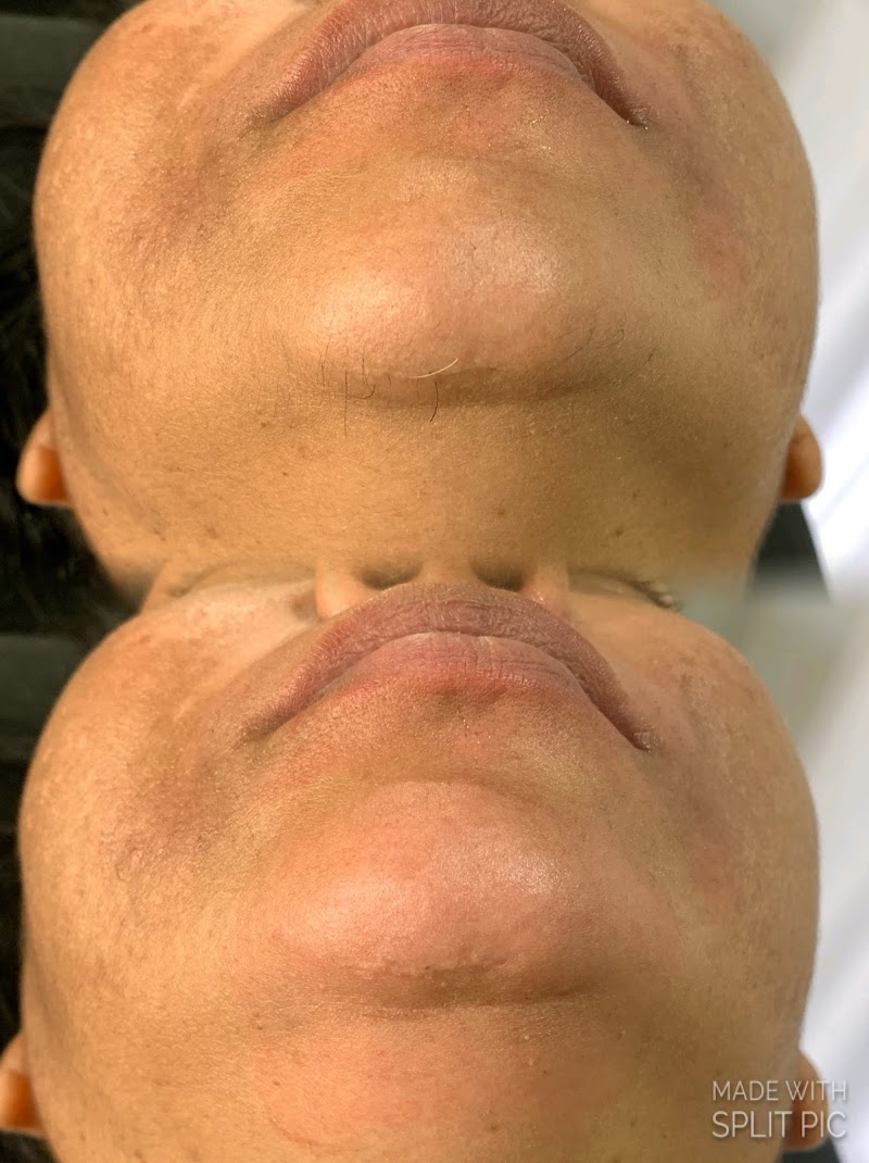 Janaina Depilação Patos - Day Spa in Patos