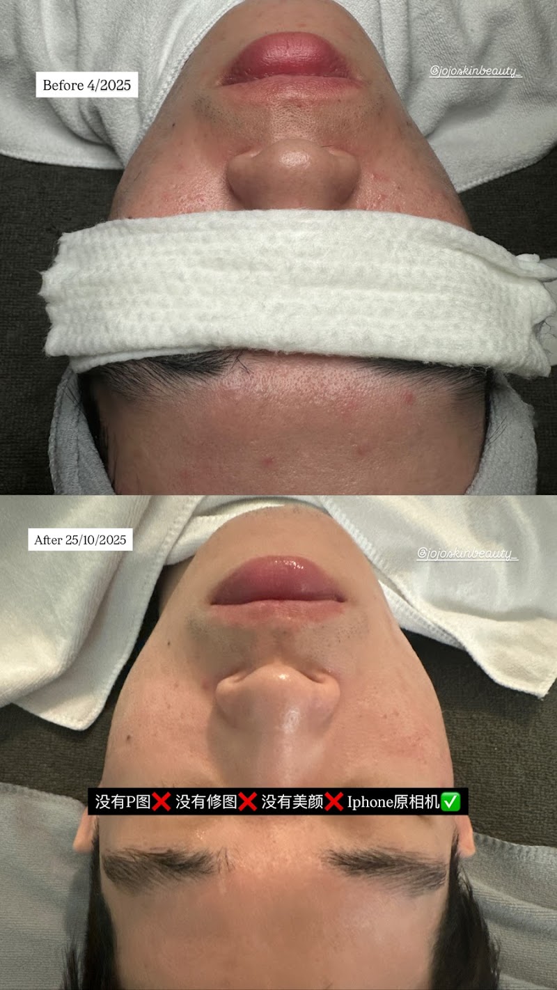 JOJO.Beauty Skin PC Puchong - Day Spa in Puchong