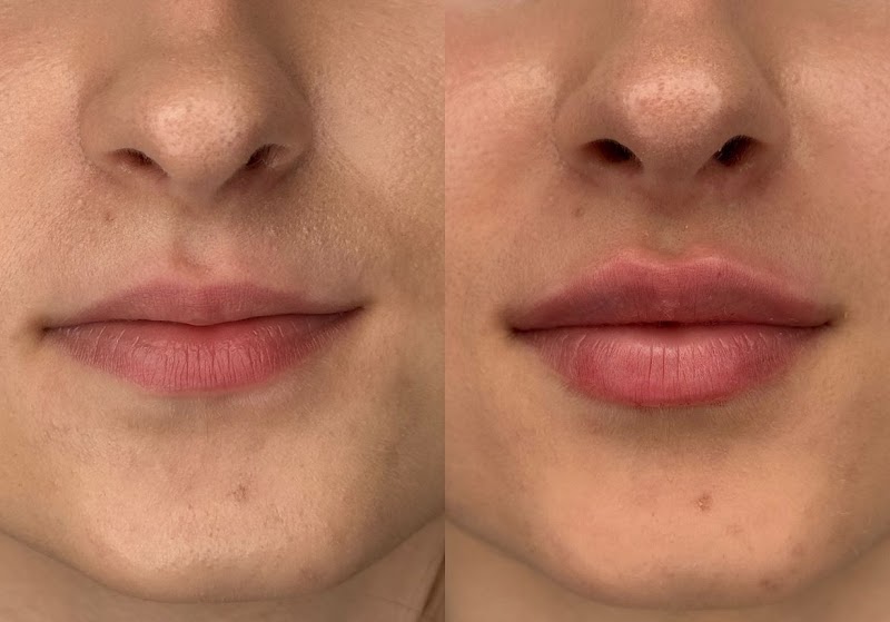 Jordana Karpiuk Azevedo Lajeado - Day Spa in Lajeado