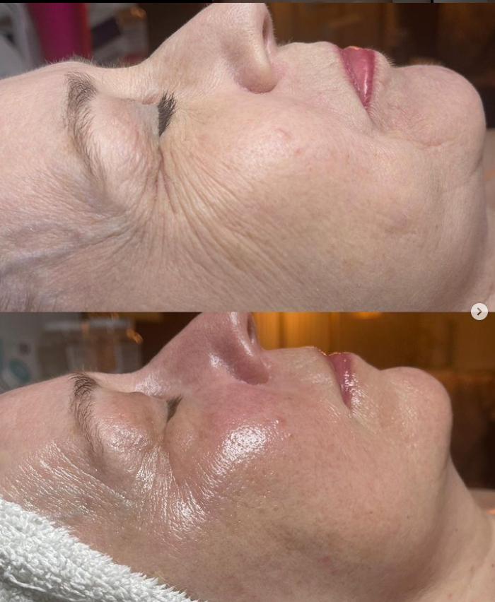 Lauren Jewel Aesthetics Jefferson - Day Spa in Jefferson