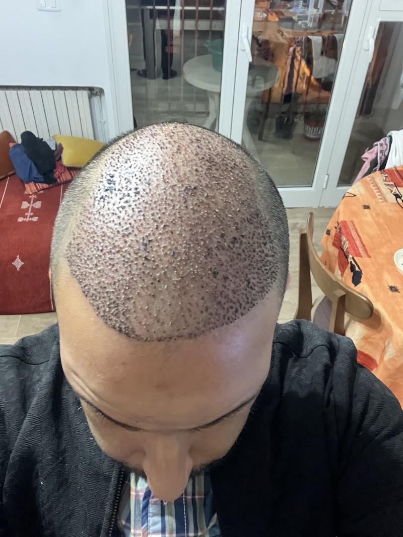 Lazéo dermolazer Tunis - Day Spa in Tunis