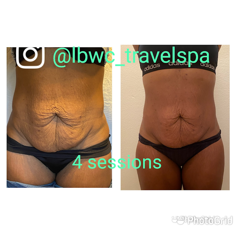 Life Balance Wellness Center Pompano Beach - Wellness Retreat in Pompano Beach