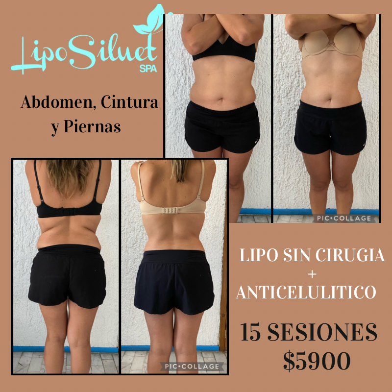 Liposiluet Spa Guadalajara - Day Spa in Guadalajara