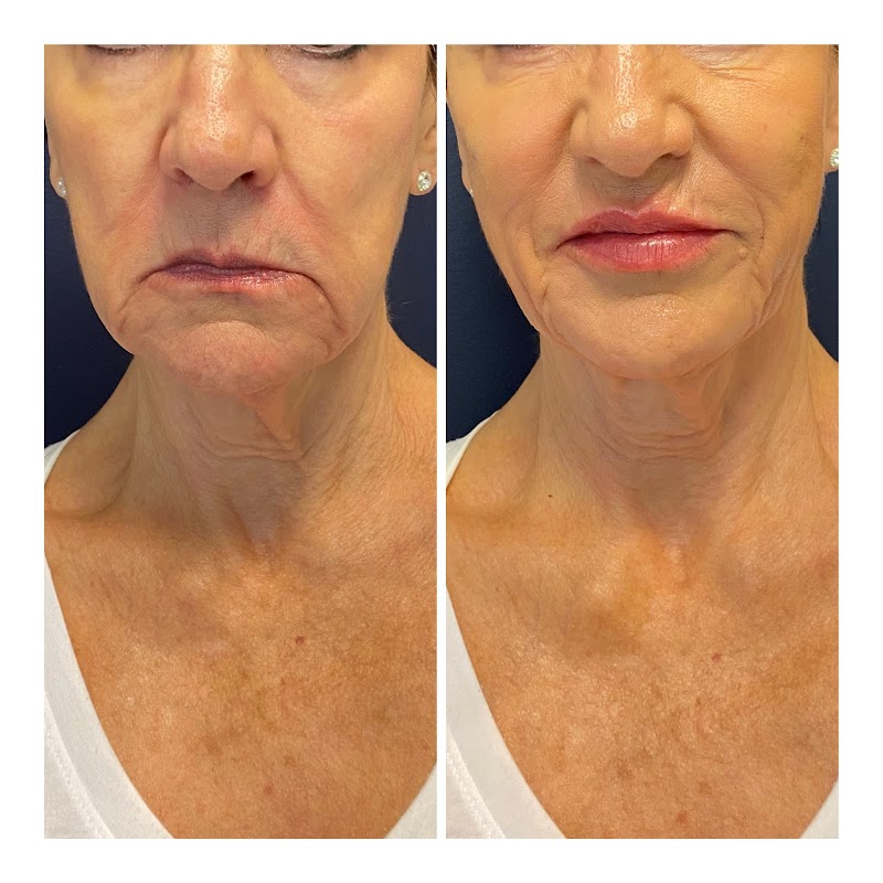 Lori Mitchell RN Folsom - Day Spa in Folsom