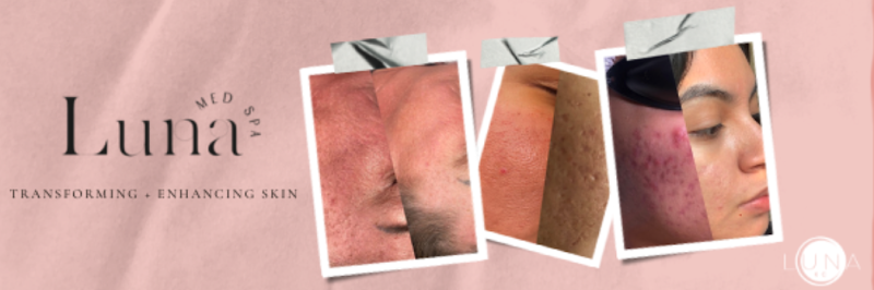 Luna Esthetics & Wellness Kansas City - Wellness Retreat in Kansas City