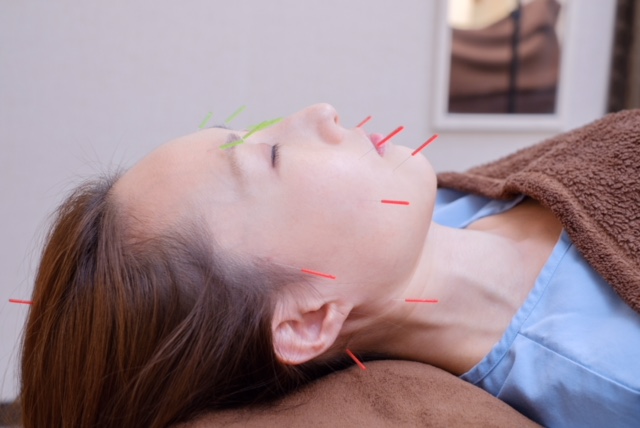 Luna Sole Beauty Acupuncture Salon Tsuzuki Ward, Yokohama City - Day Spa in Tsuzuki Ward, Yokohama City