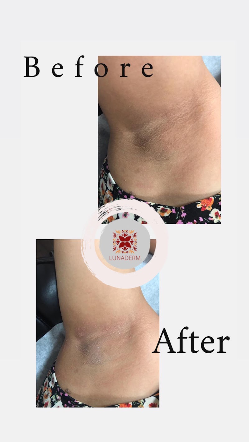 Lunadermspa Torrance - Day Spa in Torrance