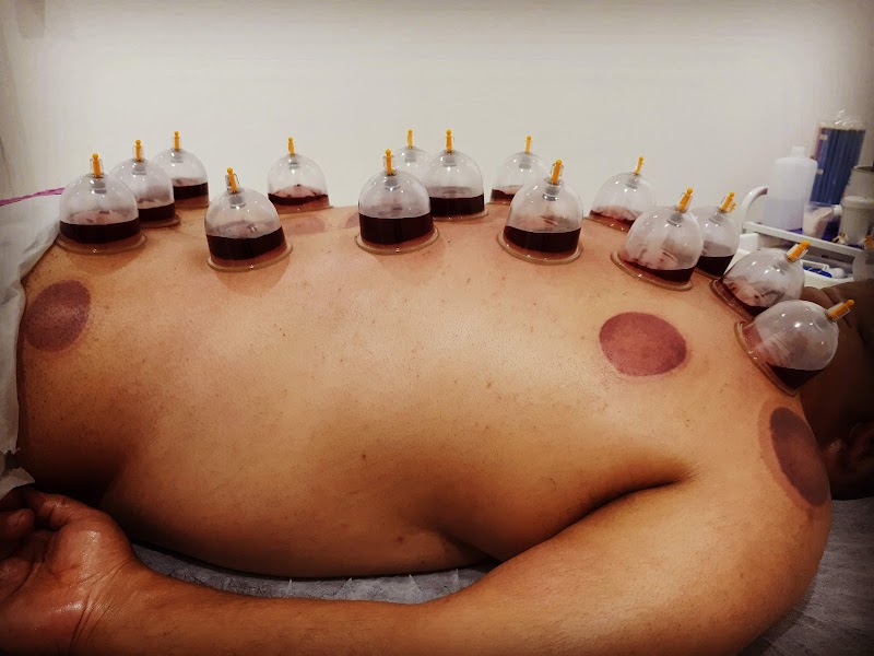 Ma'akum for Hijama and Complementary Medicine Umm al-Fahm - Day Spa in Umm al-Fahm