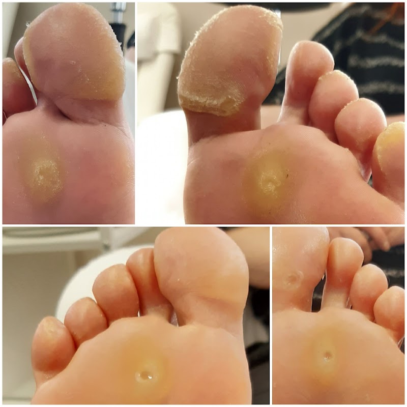 Ma petite Pédicure Erquelinnes - Day Spa in Erquelinnes