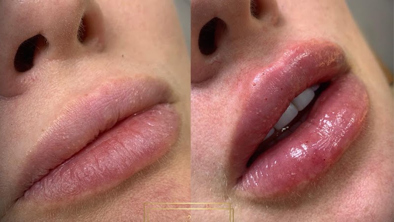 Mary Estética Corpo e Rosto Fortaleza - Day Spa in Fortaleza