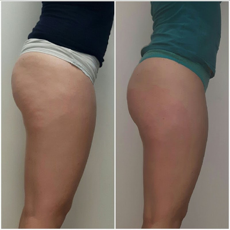 Masaže Nina Ravne na Koroškem - Day Spa in Ravne na Koroškem