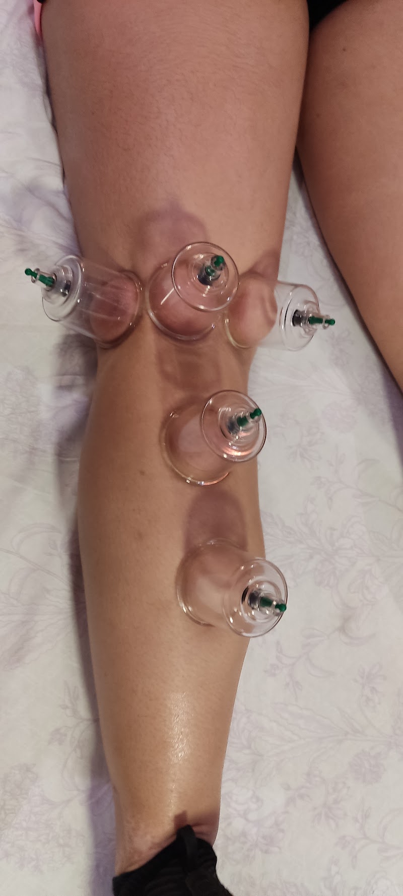 Hortolândia massagemrelax47 - Day Spa in Hortolândia