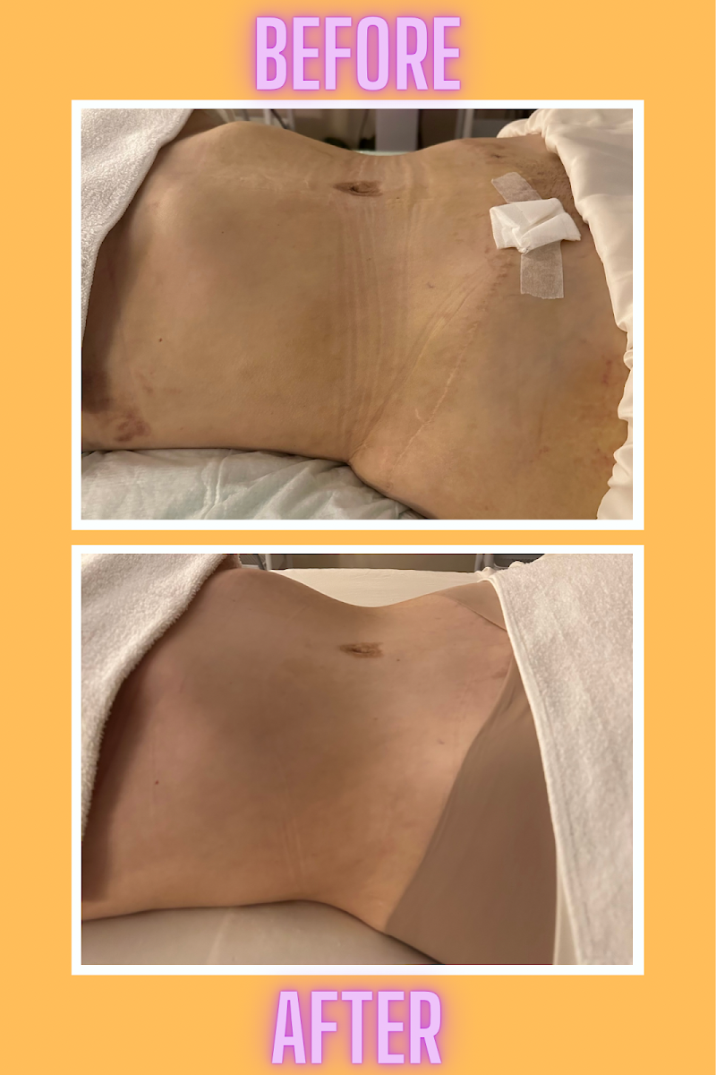 Massages   by Triny McAllen - Day Spa in McAllen