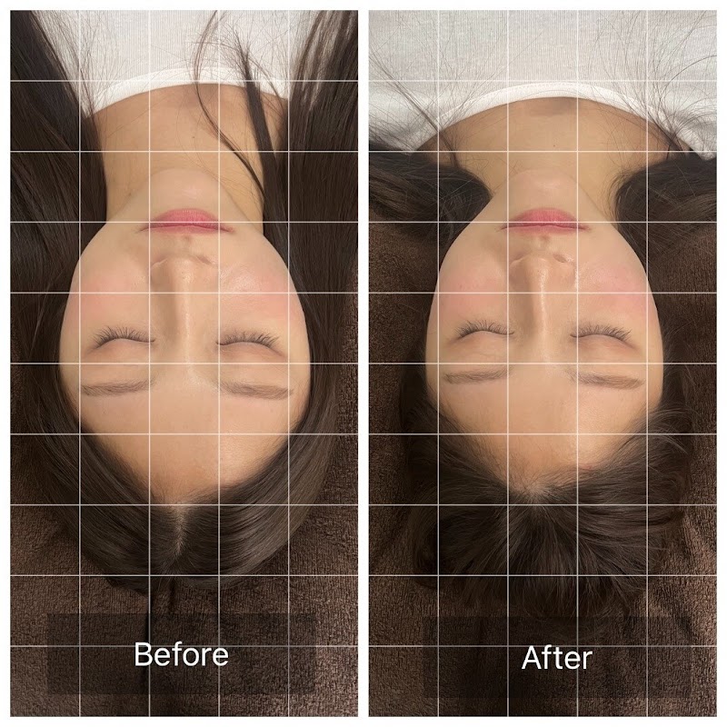 Matsumoto Osteopathic Clinic Acupuncture Clinic Toyonaka City - Day Spa in Toyonaka City