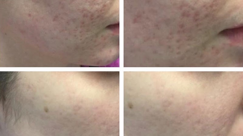 Mirta Moyano Skin Care & Body Spa Long Beach - Day Spa in Long Beach