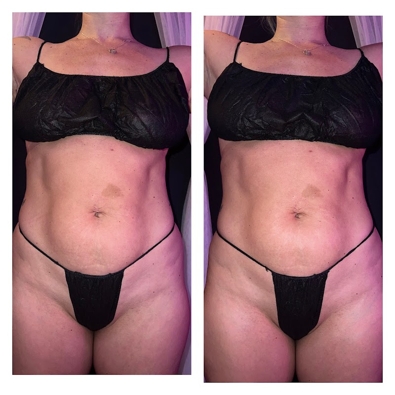 Molly Reed LMT Buffalo - Day Spa in Buffalo