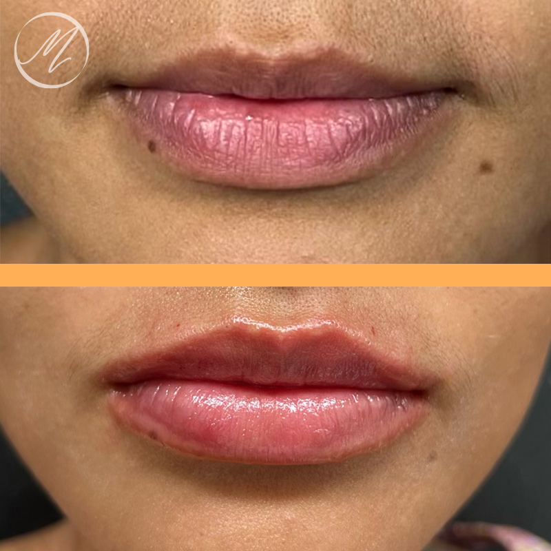 Montecito Med Spa - Medical Spa in Montecito