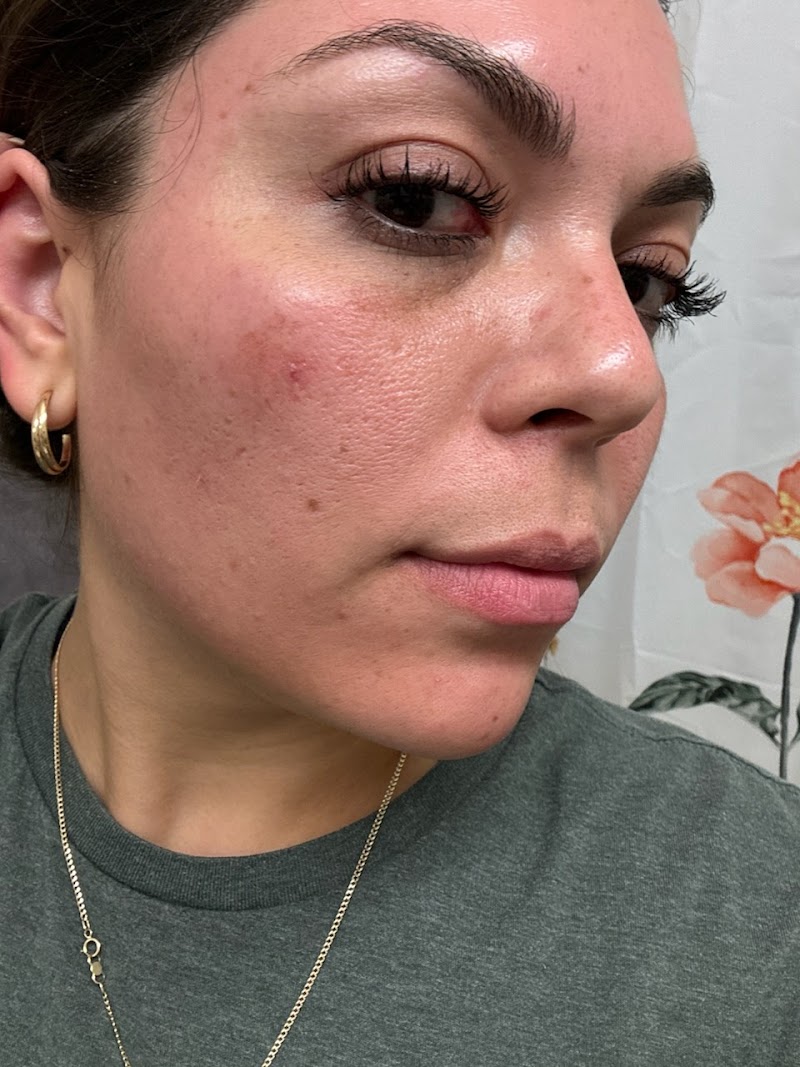 Moonstone - Skincare & Spa Katy - Day Spa in Katy