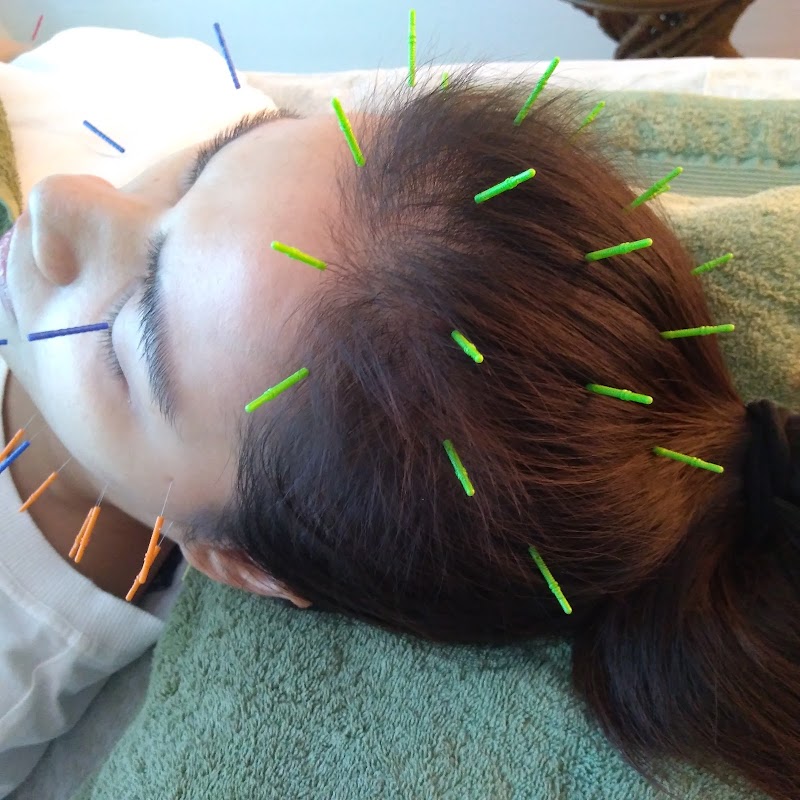 New Beauty Acupuncture sola Shinagawa Ward - Day Spa in Shinagawa Ward