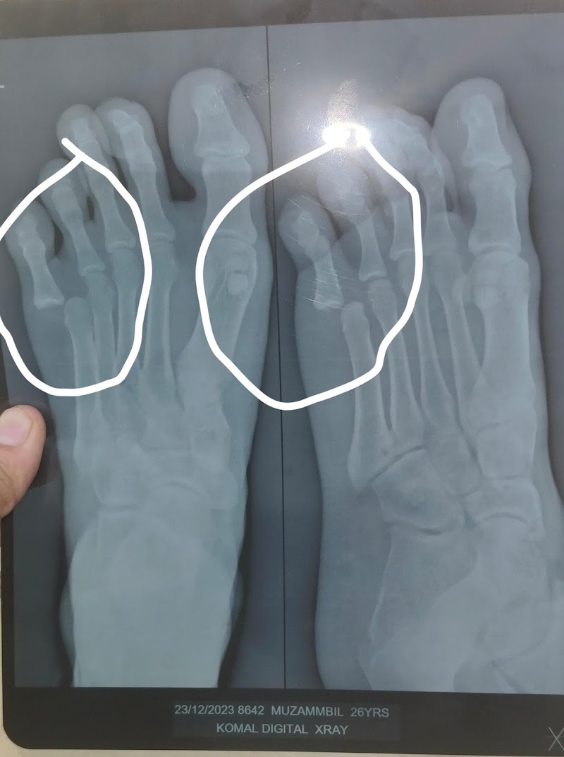 Nisar Ahmed Bone setter -hadvaidh Mumbai