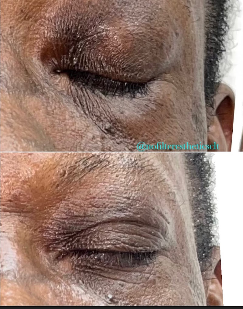 No Filter Esthetics Charlotte - Day Spa in Charlotte