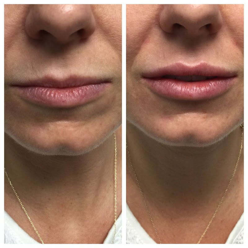 NP Choice Rejuvenation Smithtown - Day Spa in Smithtown