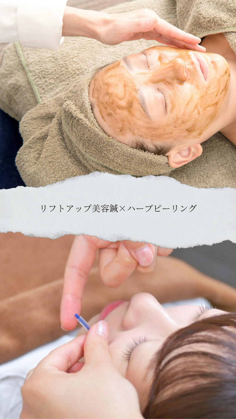 Ohanaroom Acupuncture Treatment Clinic Nerima City - Day Spa in Nerima City