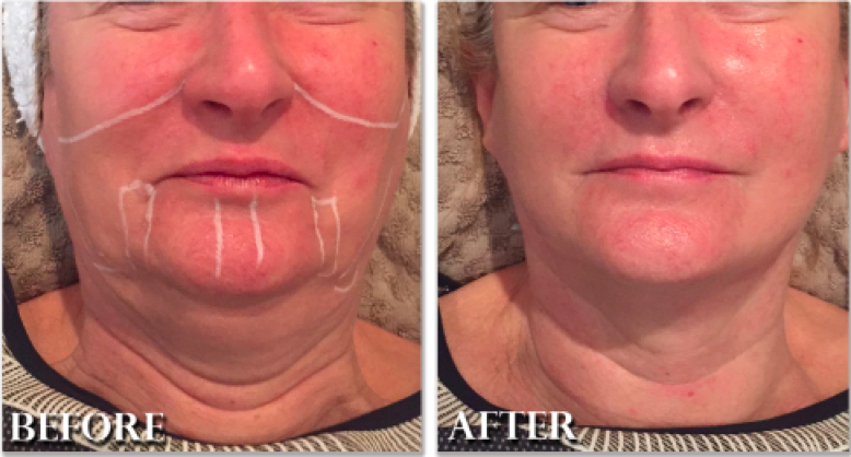 Organica Day SPA Ulitsa Kaslinskaya - Day Spa in Ulitsa Kaslinskaya