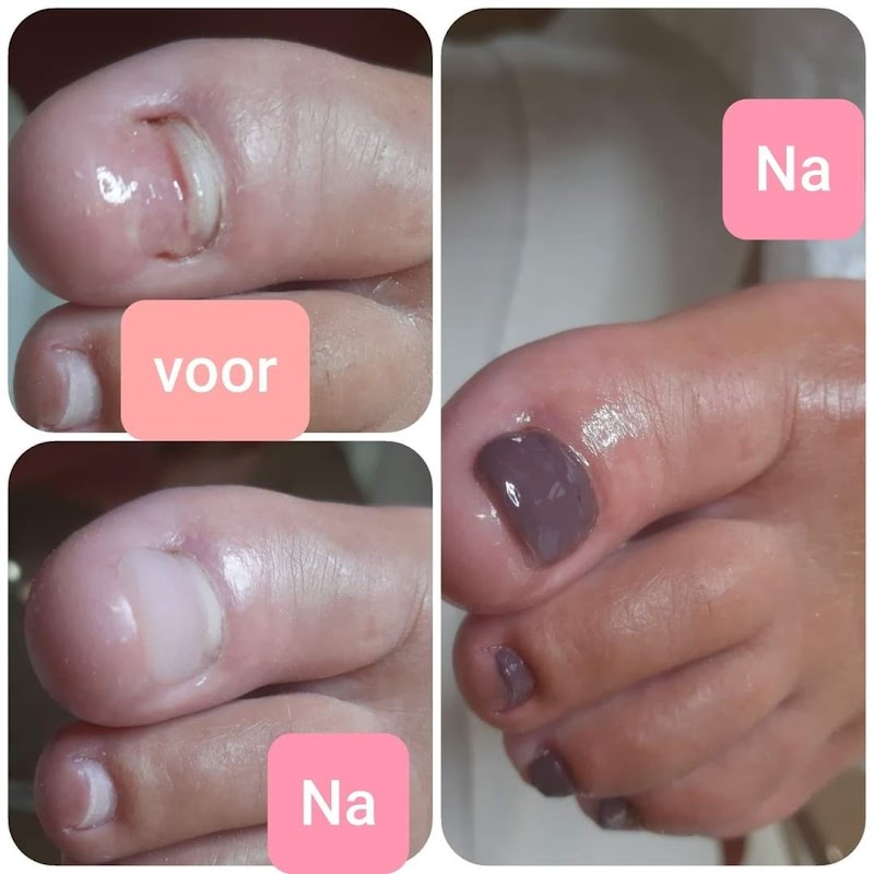Pedicure Emmy Michiels Denderleeuw - Day Spa in Denderleeuw