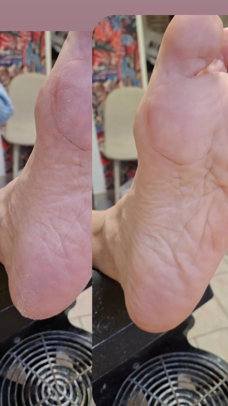 Pedikúra Osada Jirkov - Day Spa in Jirkov