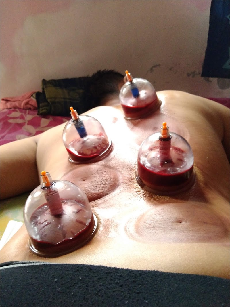 Pijat Massage dan Bekam Panggilan Bali Denpasar - Wellness Retreat in Denpasar