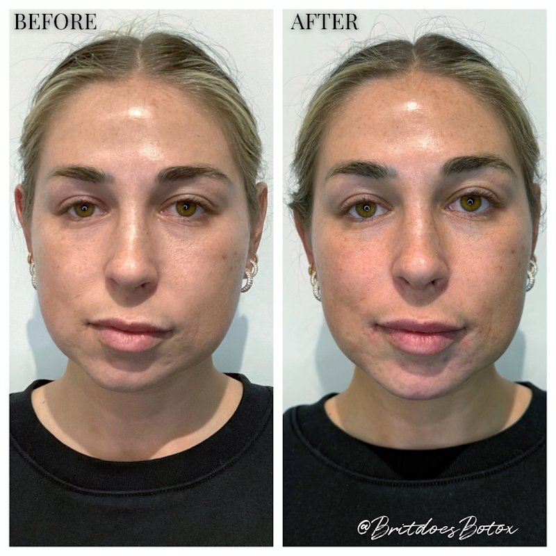 Professional Aesthetic Solutions Escondido - Day Spa in Escondido