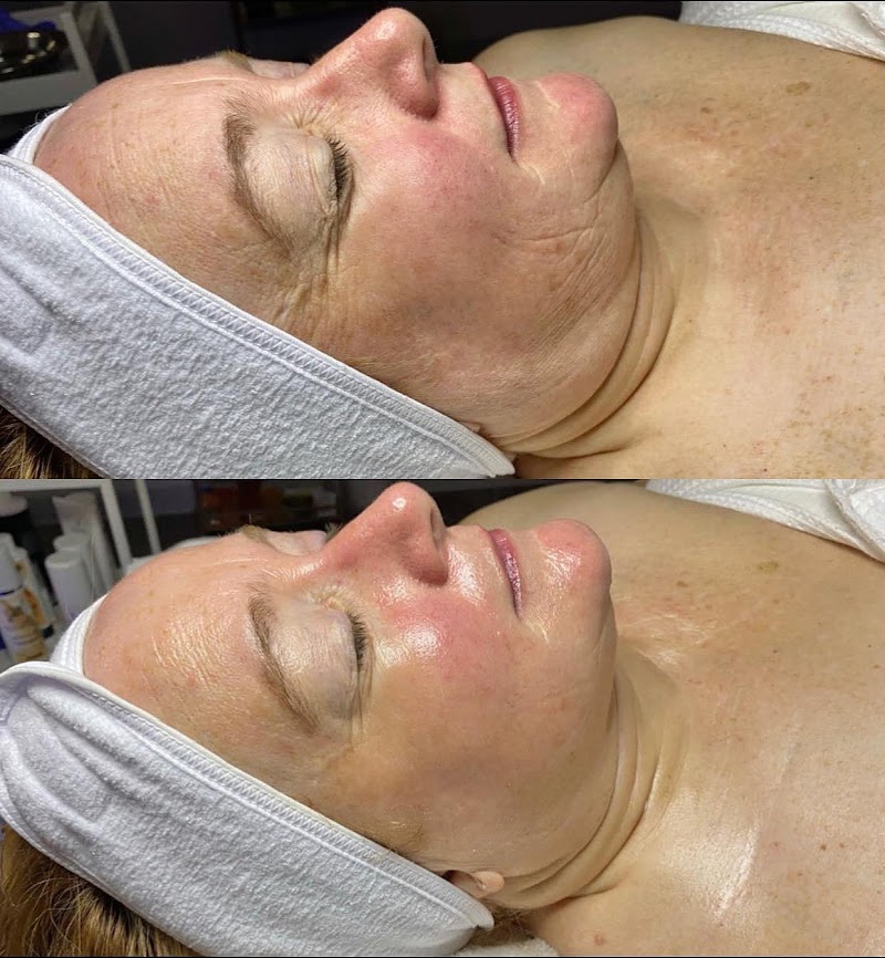 Pure Image Esthetics Willow Park - Day Spa in Willow Park