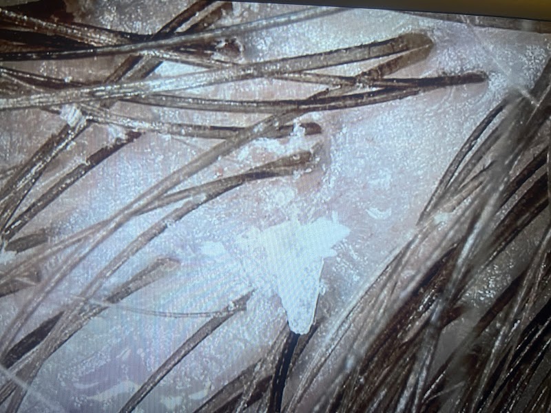 Pure Scalp Spa Brookfield - Day Spa in Brookfield