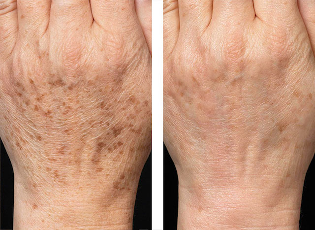 Real Results Skin Care Therapy Fayetteville - Day Spa in Fayetteville