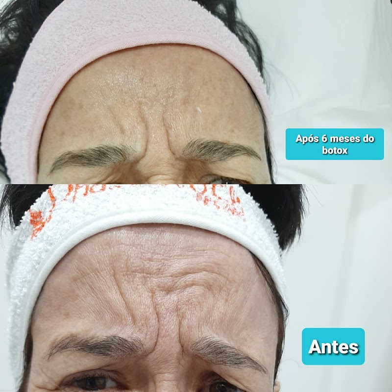 Realce Estetica Salgueiro - Day Spa in Salgueiro