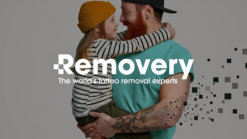 Removery Tattoo Removal & Fading Toronto photo