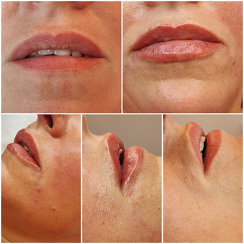 Renew Medi Spa Norwich - Day Spa in Norwich