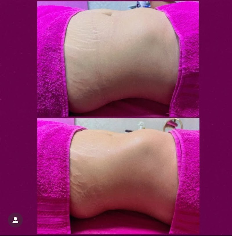 Renovarte Centro Estético Passo Fundo - Day Spa in Passo Fundo