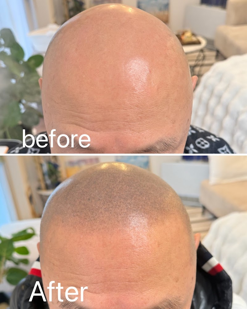 Scalp Hair Quality Improvement Hair Esthe Aires Sapporo Maruyama Store Sapporo Chuo Ward - Day Spa in Sapporo Chuo Ward