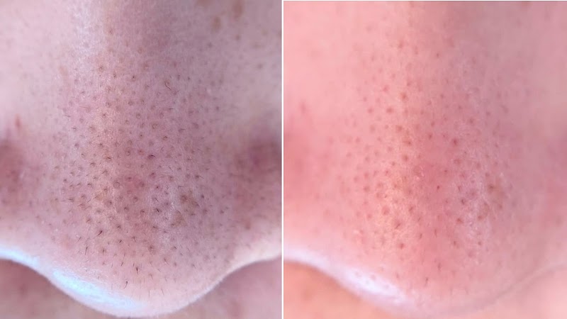 Seitai Salon Fuu Shimogyo Ward, Kyoto City - Day Spa in Shimogyo Ward, Kyoto City