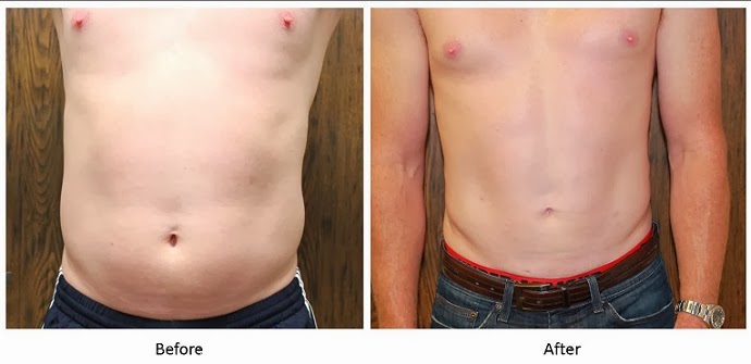 SF Bay Cosmetic Surgery Medical Group Oakland - Medical Spa in Oakland